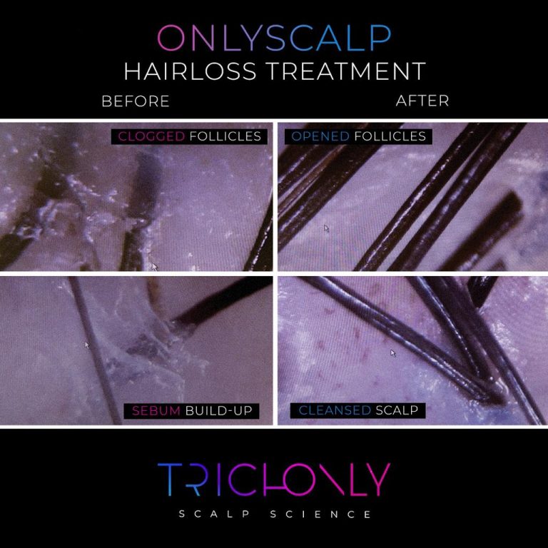 TrichOnly Hair & Scalp Treatments Before & After Images