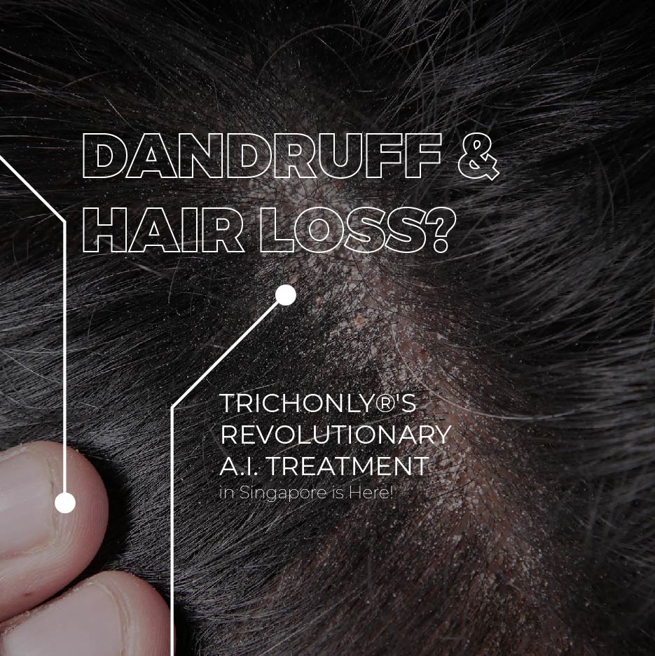 Say goodbye to pesky dandruff with TrichOnly®'s revolutionary A.I. dandruff treatment in Singapore. Get a flaky-free scalp and prevent hair loss with our personalized treatment plans.