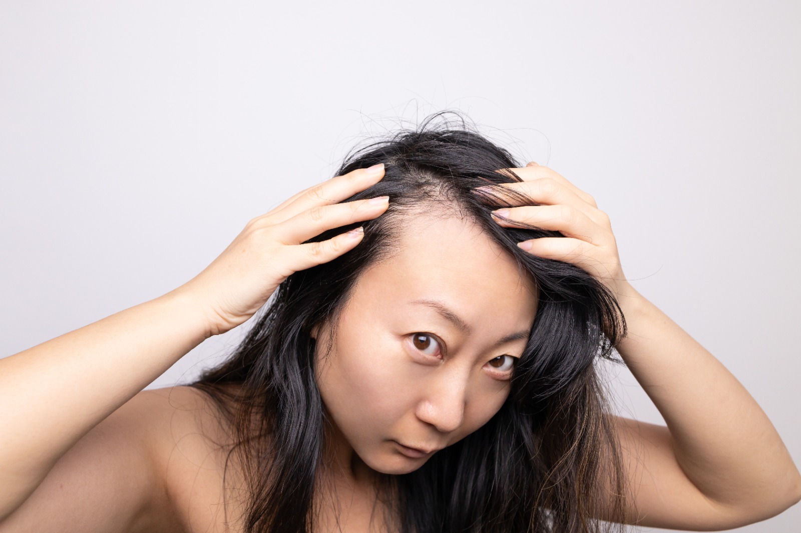 Unlocking the Secrets to a Healthy Scalp: Common Hair & Scalp Problems.